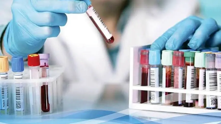 Laboratory and Diagnosis