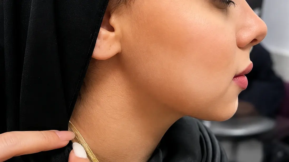 قبل و بعد نتیجه بعد