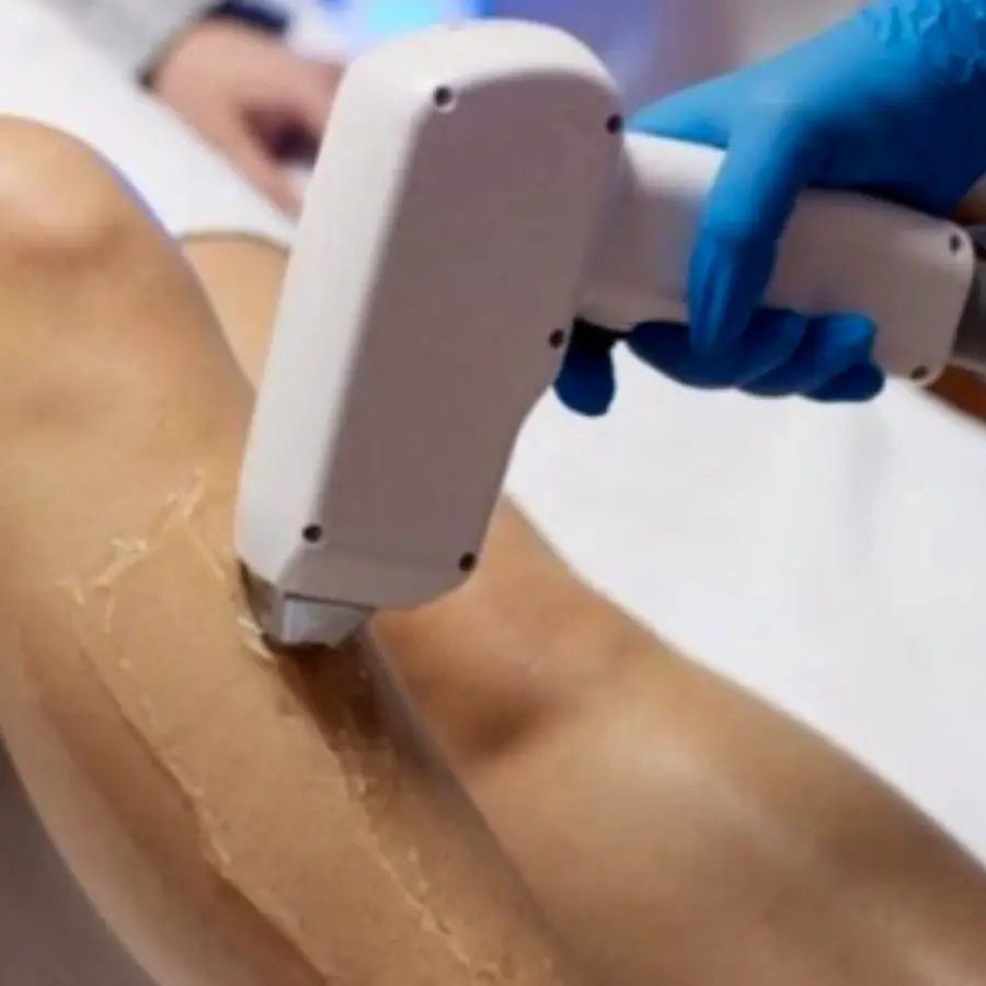 Laser Hair Removal