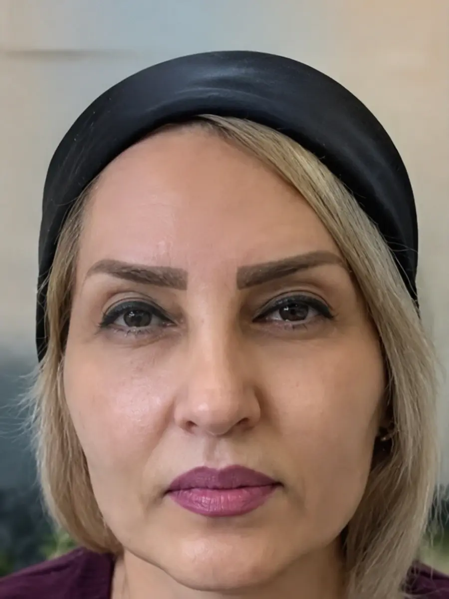 قبل و بعد نتایج ثبت شده قبل