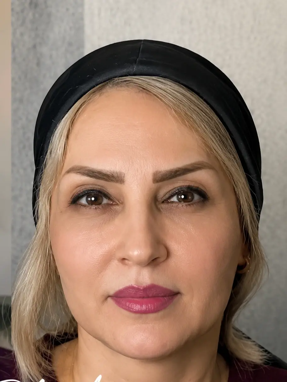 قبل و بعد نتایج ثبت شده بعد