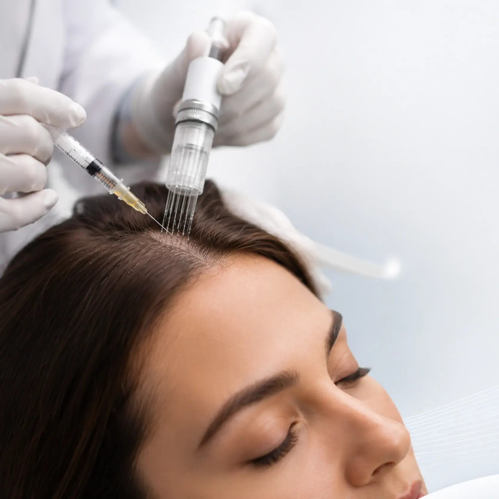 PRP and Mesotherapy